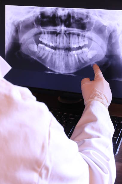 Best Emergency Dental Care for Broken or Chipped Teeth in Zwolle, LA