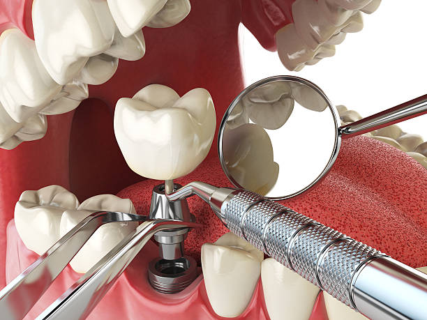 Trusted LA Emergency Dentist Experts